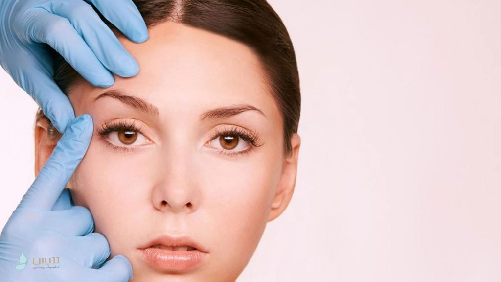 لیفت شقیقه با بوتاکس چگونه انجام می شود؟