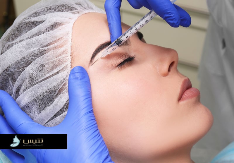 تزریق بوتاکس