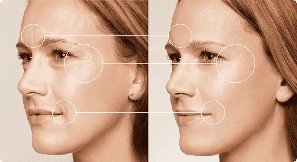 اثرات بایوفیلر