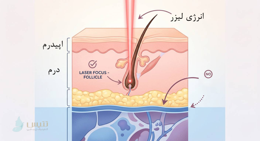 عوارض لیزر موهای زائد، آیا سرطان زاست؟