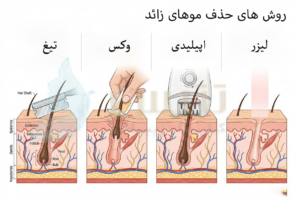 بهترین روش خلاصی از موهای زائد