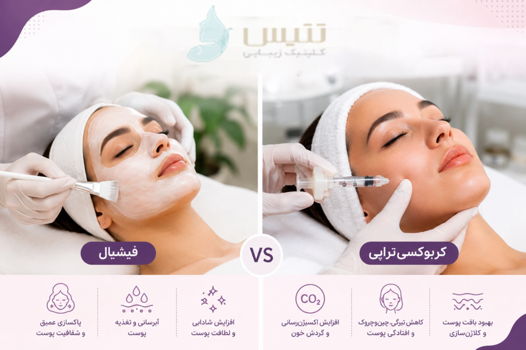 فیشیال یا کربوکسی تراپی؟